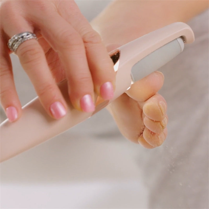 Meuleuse électrique pour les pieds BERDA™